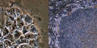 左から、ヒト胚性幹（ES）細胞・人工多能性幹（iPS）細胞 （写真）
